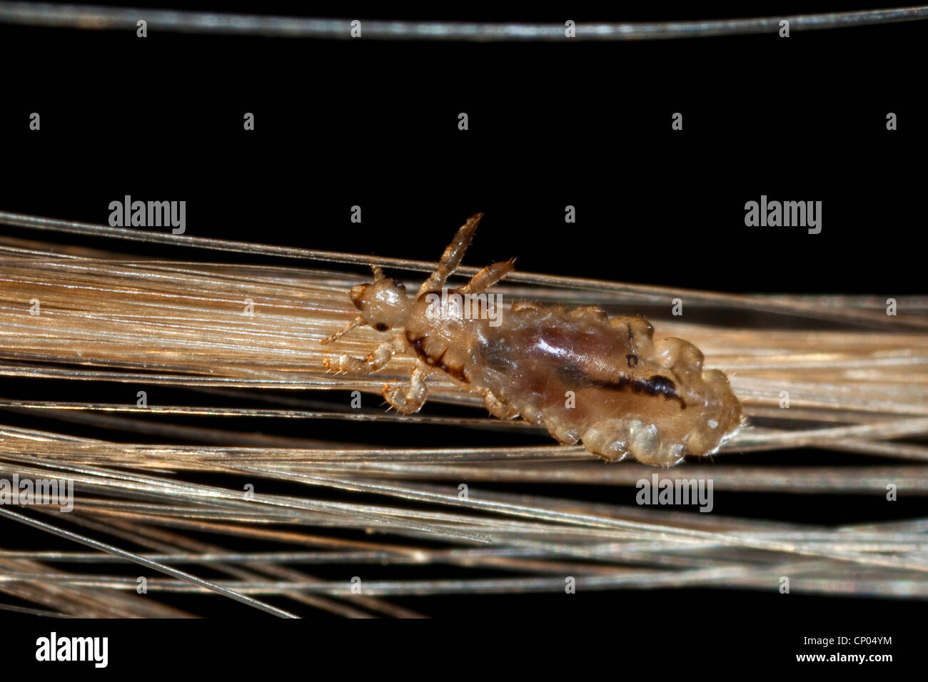 head louse (Pediculus capitis, Pediculus humanus capitis, Pediculus humanus), louse in human hair, Germany Stock Photo