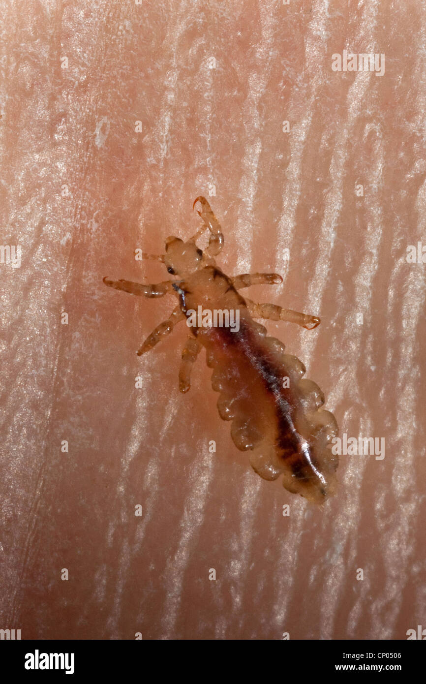 head louse (Pediculus capitis, Pediculus humanus capitis, Pediculus humanus), louse on human skin, Germany Stock Photo