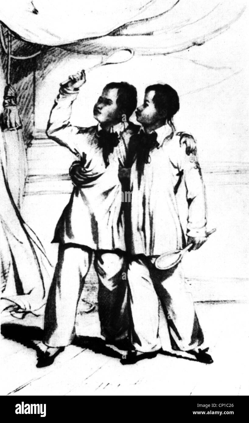 medicine, anomalies, Siamese twins, male twins, drawing, 18th century, historic, historical, misshapen, genetic defect, genetic defects, twin, anomaly, people, Additional-Rights-Clearences-Not Available Stock Photo