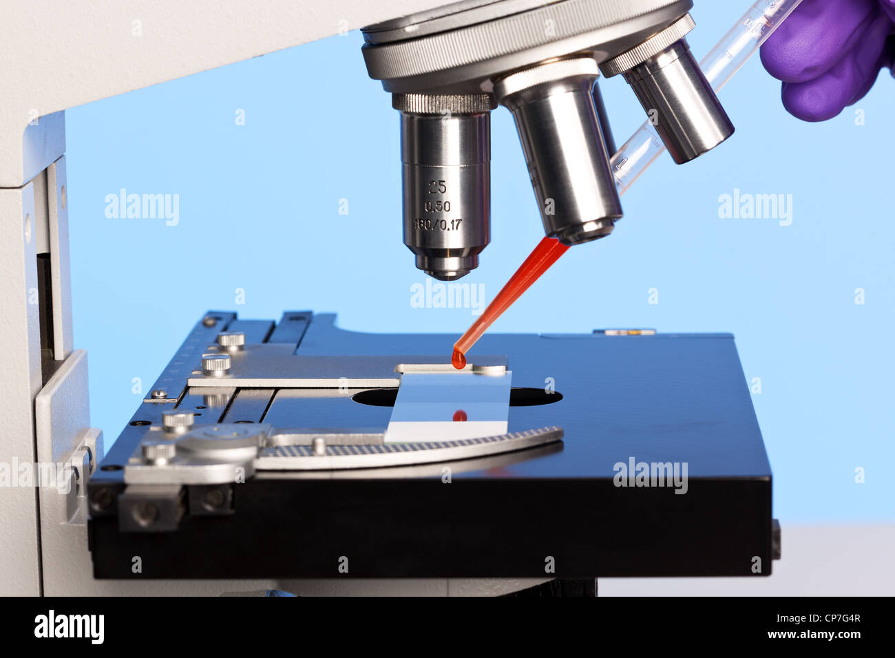 Photo of a laboratory microscope with a blood sample on a glass slide