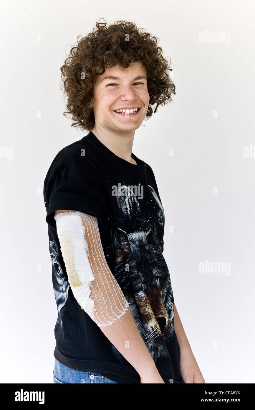 Boy with injured arm Stock Photo Alamy