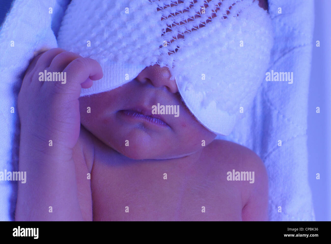 A one day old baby having photo therapy for jaundice Stock Photo