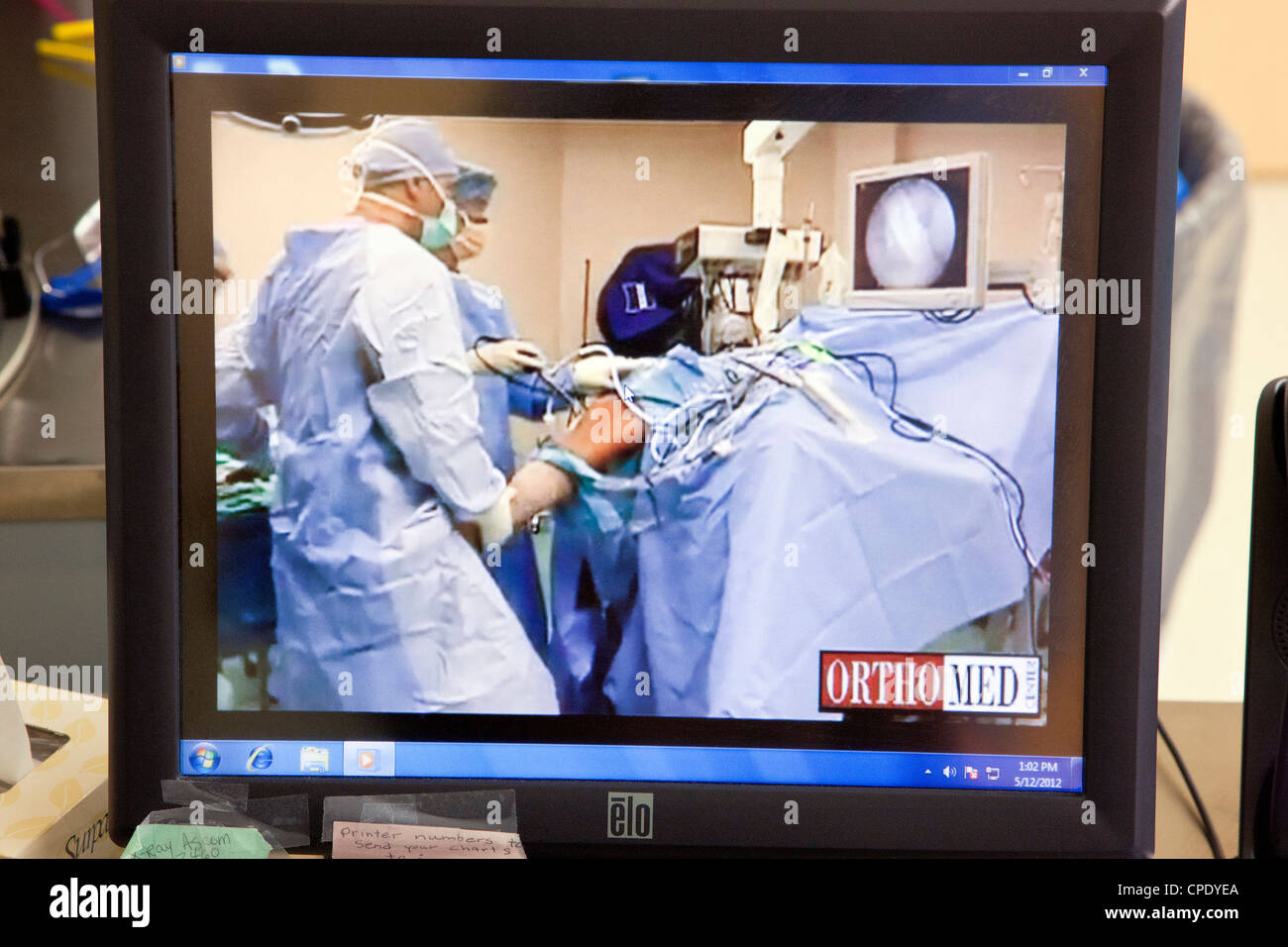 Arthroscopic knee surgery displayed on a hospital operating room computer monitor Stock Photo