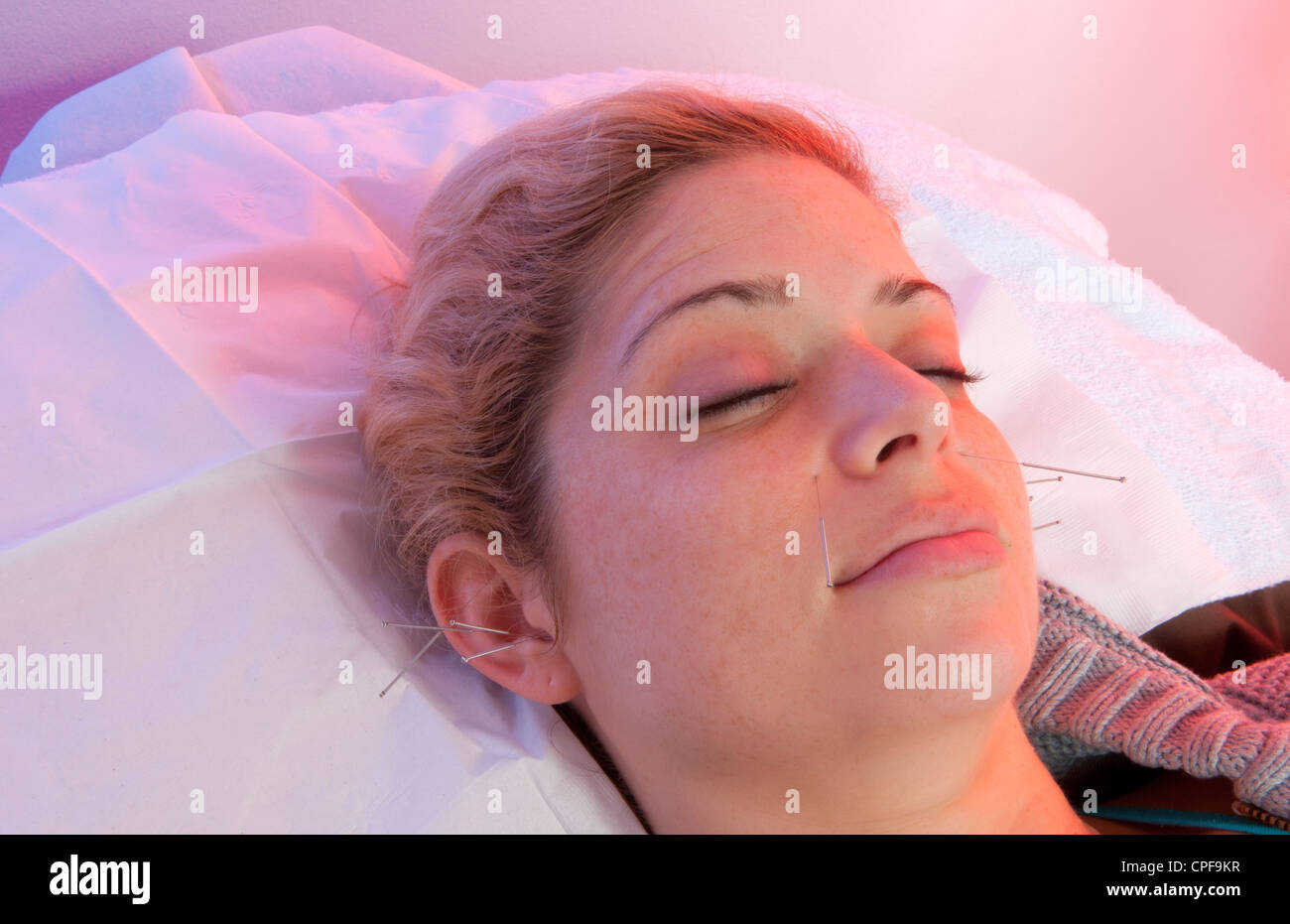 Young woman patient of acupuncture getting ear and face needles