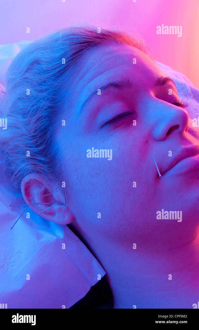 Young woman patient of acupuncture getting ear and face needles