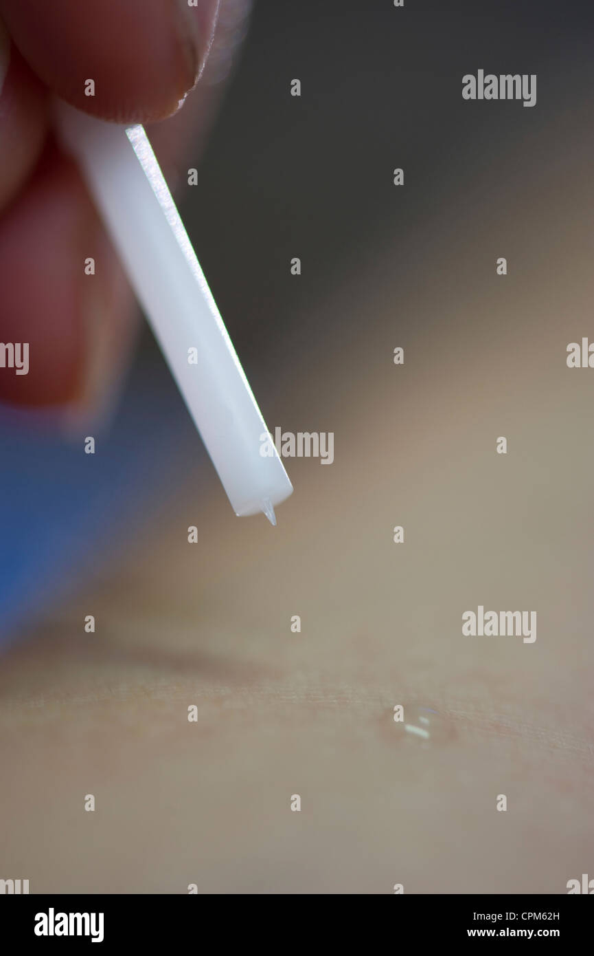 Allergy skin test needle hires stock photography and images Alamy