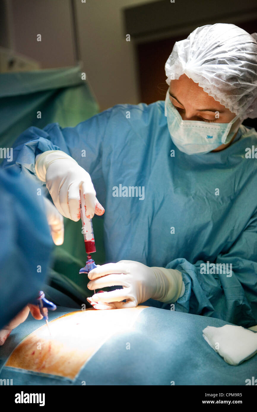 BONE MARROW ASPIRATION Stock Photo Alamy