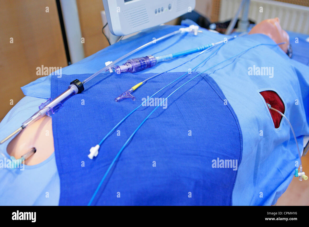 HEART VALVE PROTH. IMPLANTATION Stock Photo Alamy