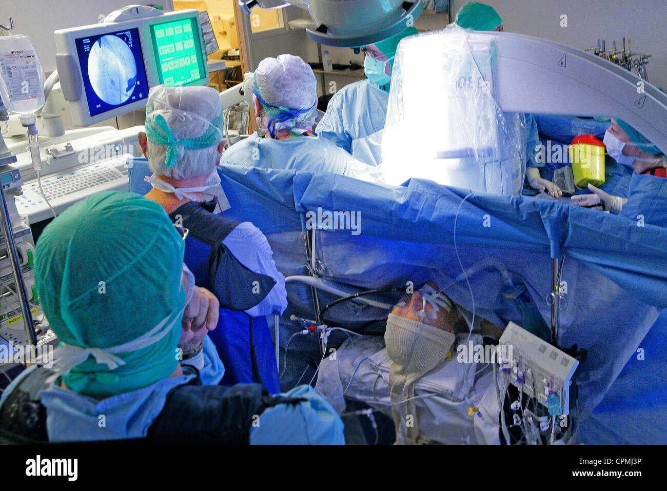 HEART VALVE PROTH. IMPLANTATION Stock Photo Alamy