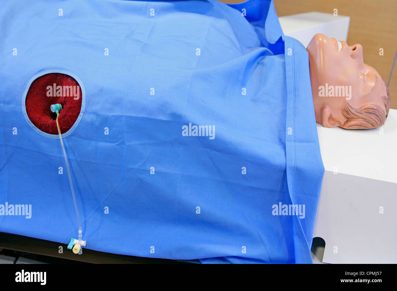 HEART VALVE PROTH. IMPLANTATION Stock Photo Alamy