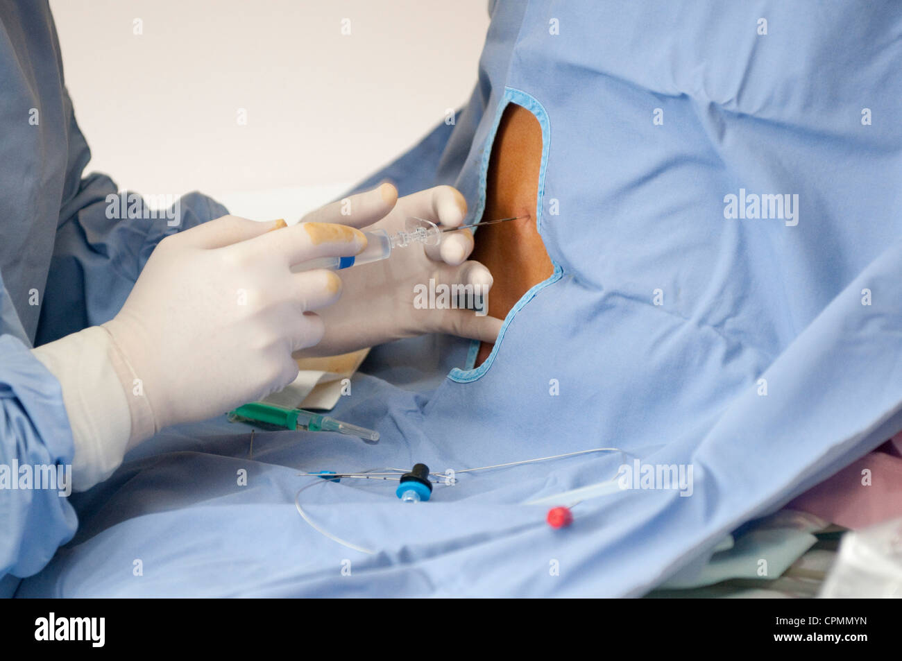 Epidural catheter hires stock photography and images Alamy