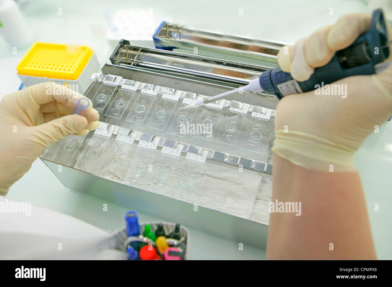 Specimen slides hi-res stock photography and images - Alamy