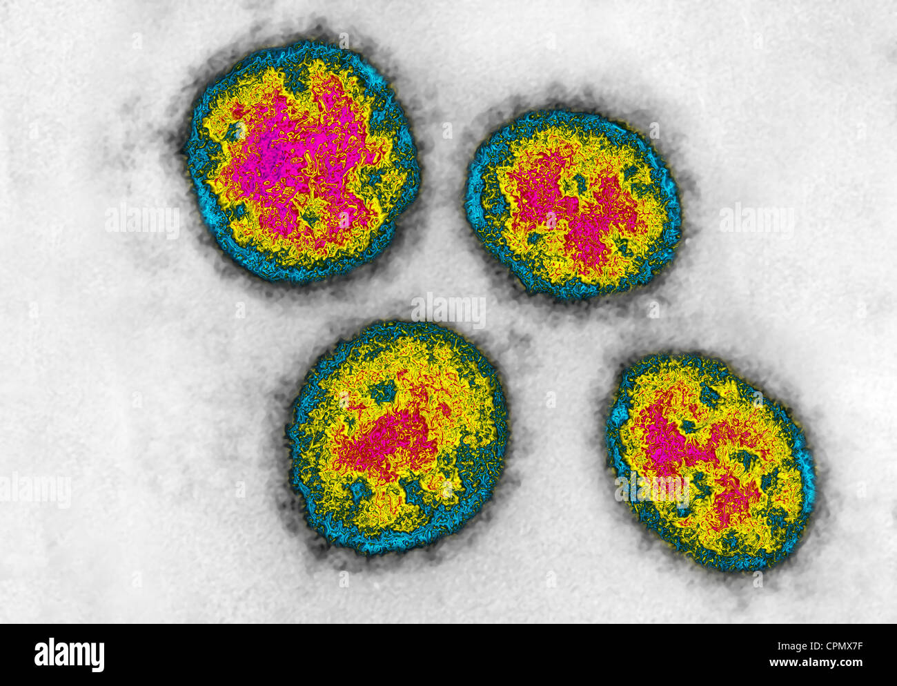 Lassa Fever High Resolution Stock Photography and Images - Alamy
