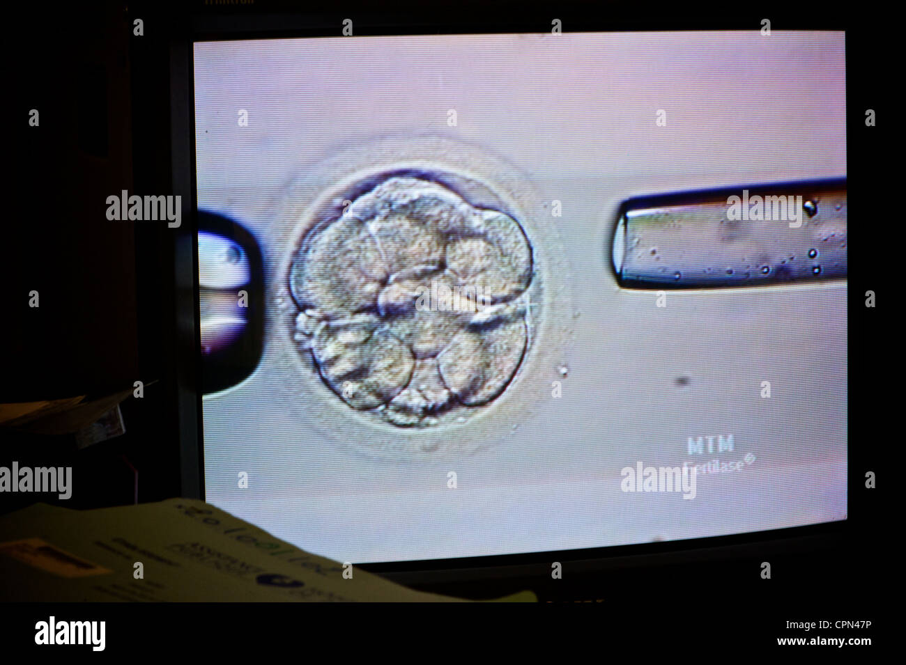 Ivf technique hi-res stock photography and images - Alamy
