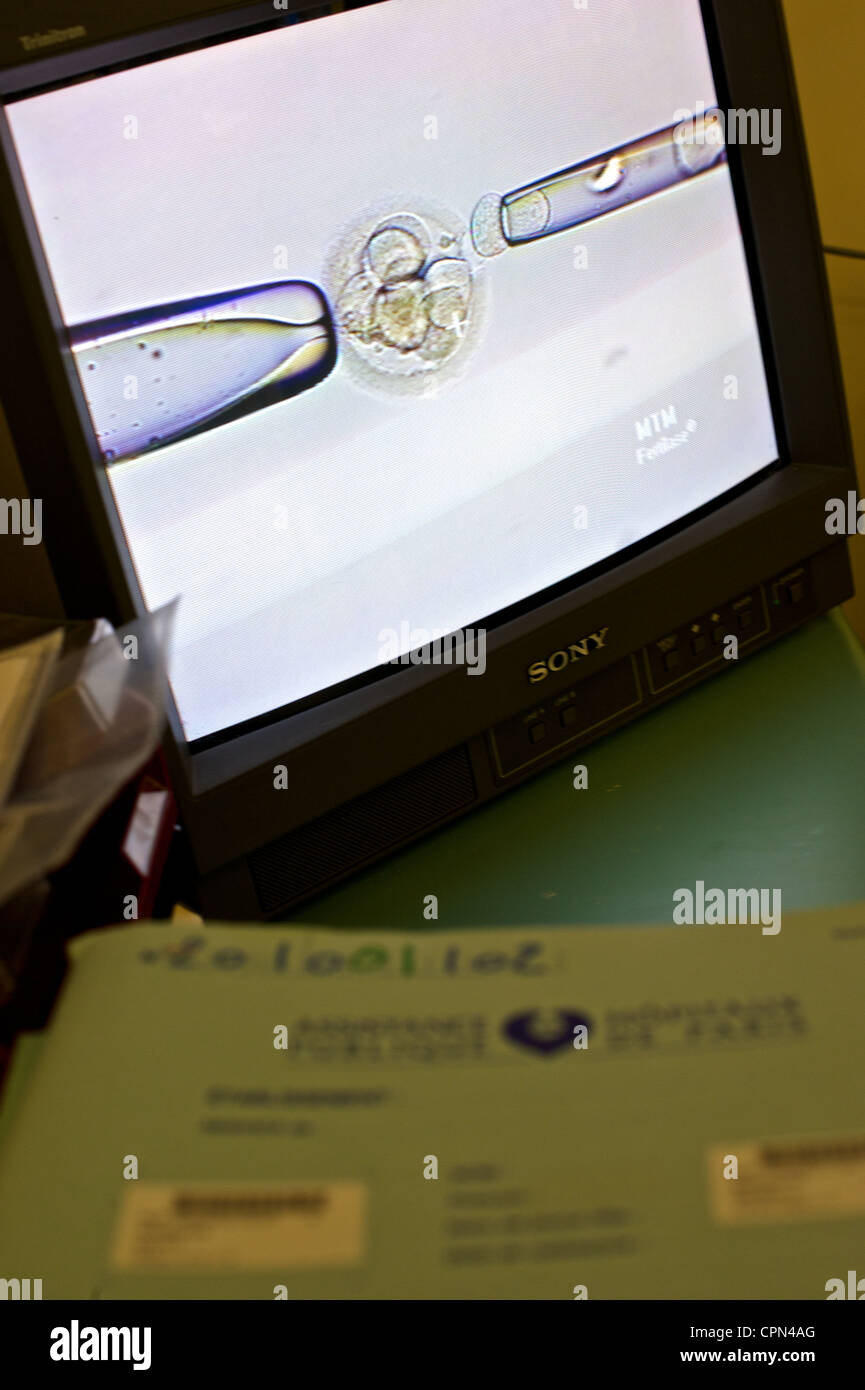 Ivf technique hi-res stock photography and images - Alamy