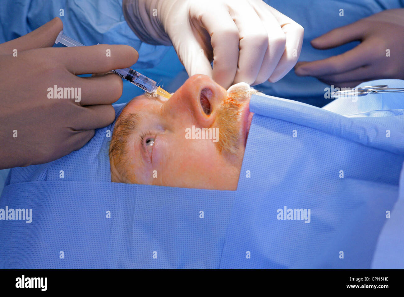 EYE SURGERY Stock Photo Alamy