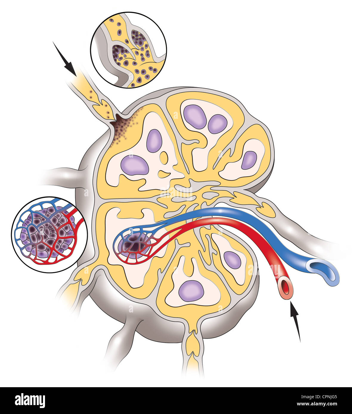 METASTASIS Stock Photo