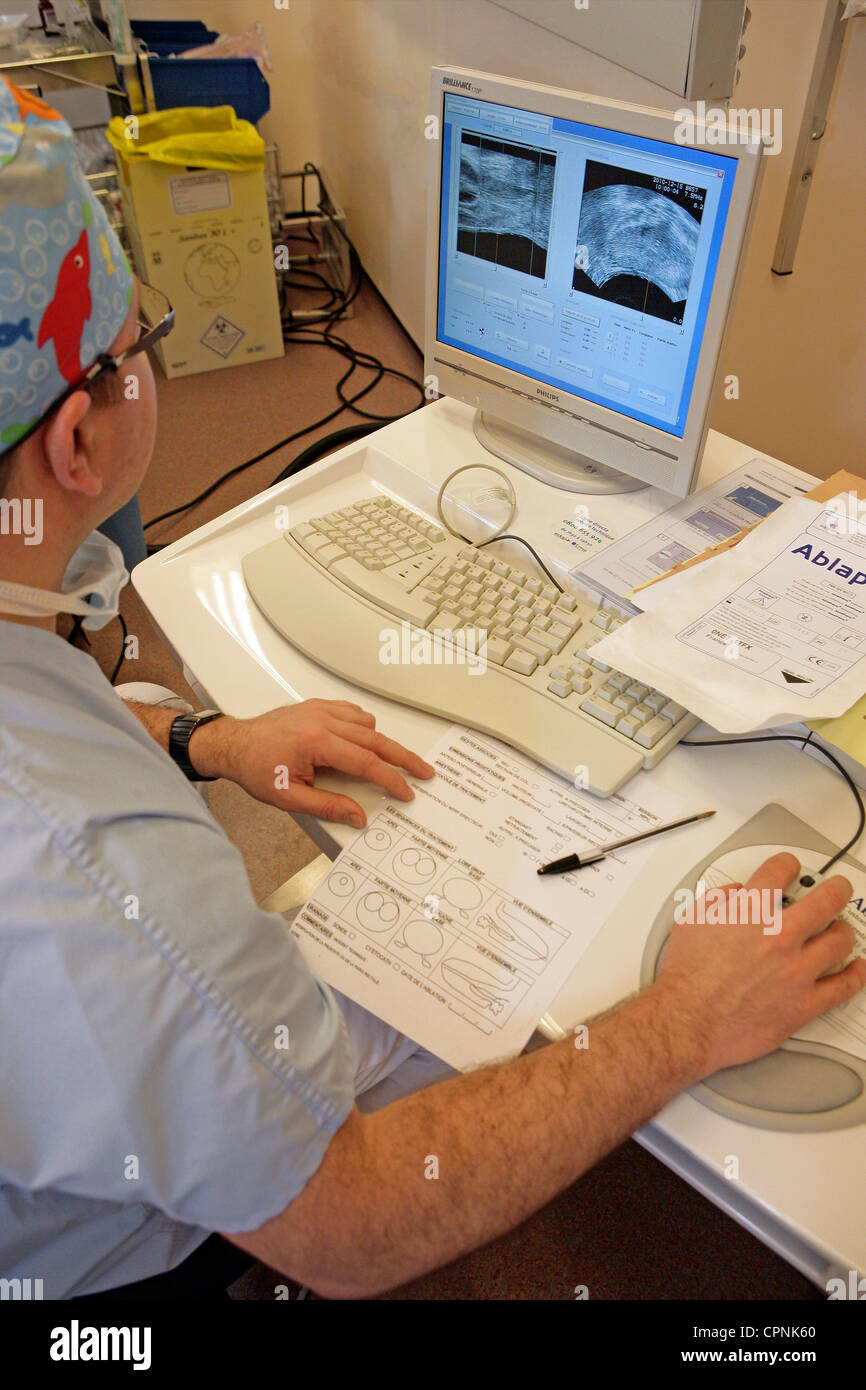 Prostate Echo CANCER OF PROSTATE ULTRASOUND Stock Photo - Alamy