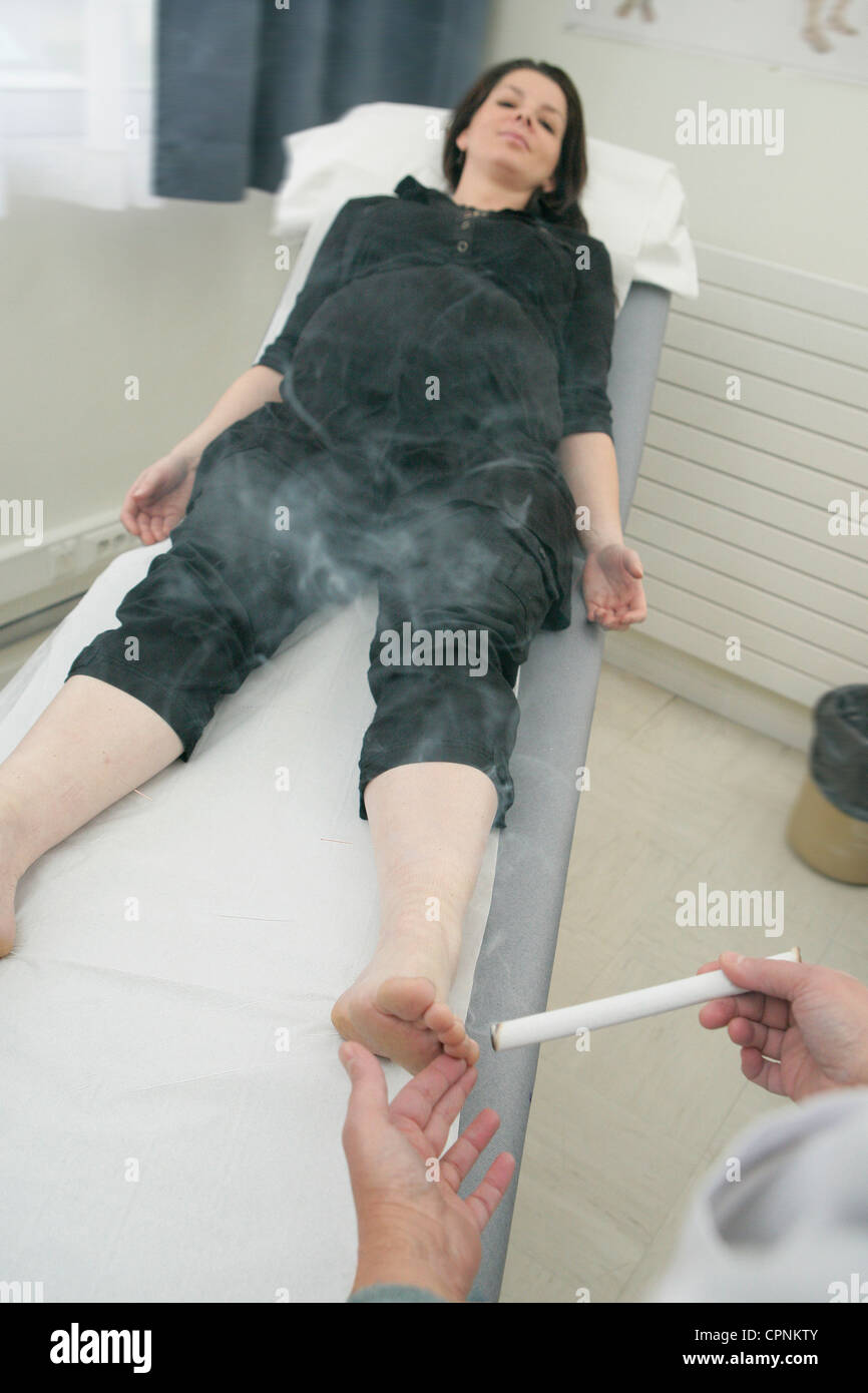 ACUPUNCTURE PREGNANT WOMAN Stock Photo Alamy