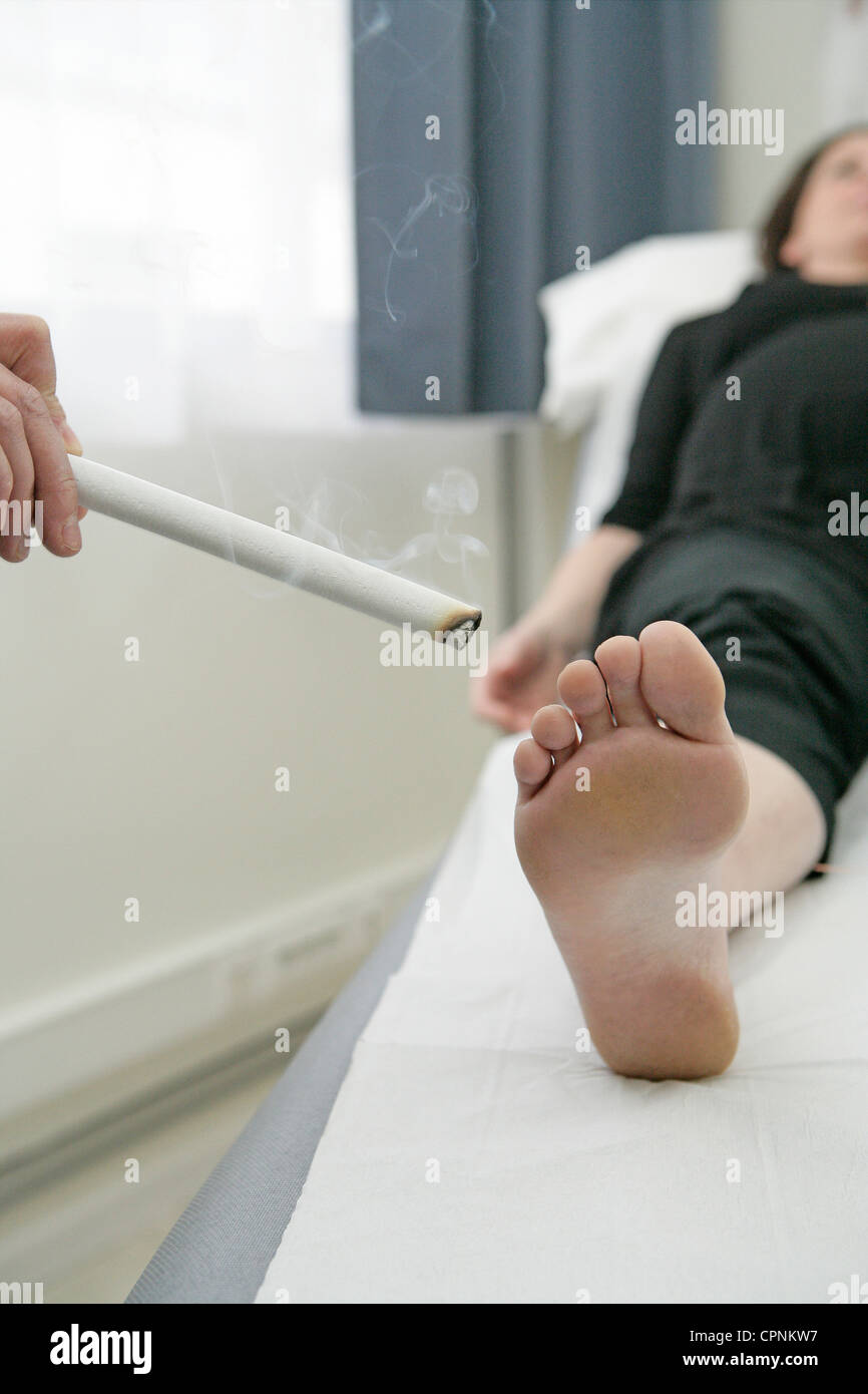 ACUPUNCTURE PREGNANT WOMAN Stock Photo Alamy