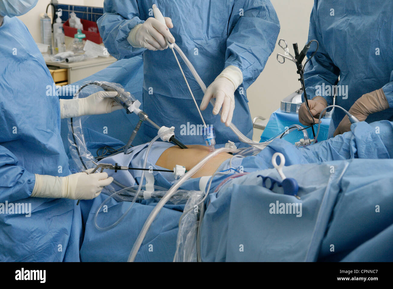 Myomectomy hires stock photography and images Alamy