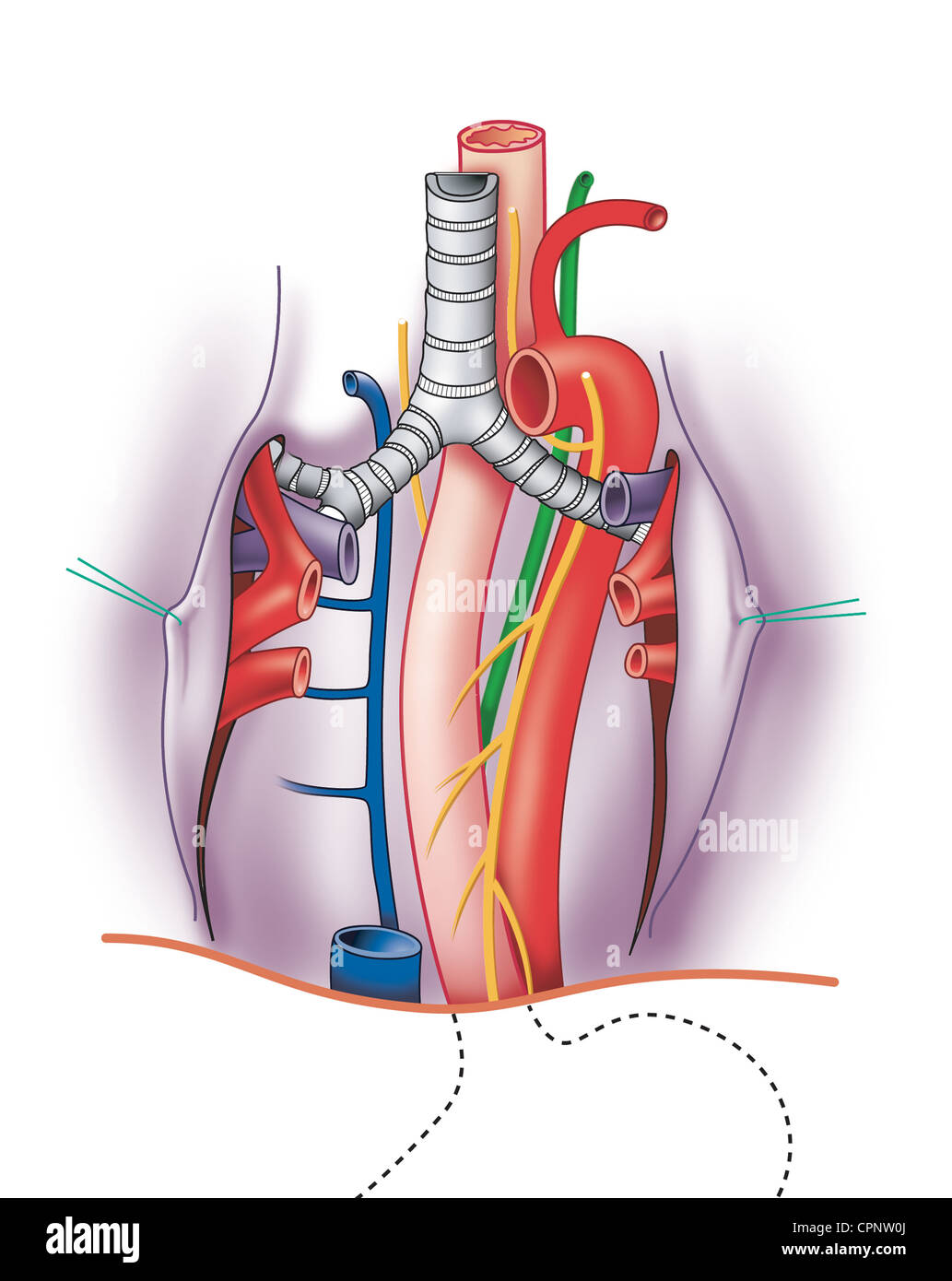 Bronchial Artery High Resolution Stock Photography and Images - Alamy