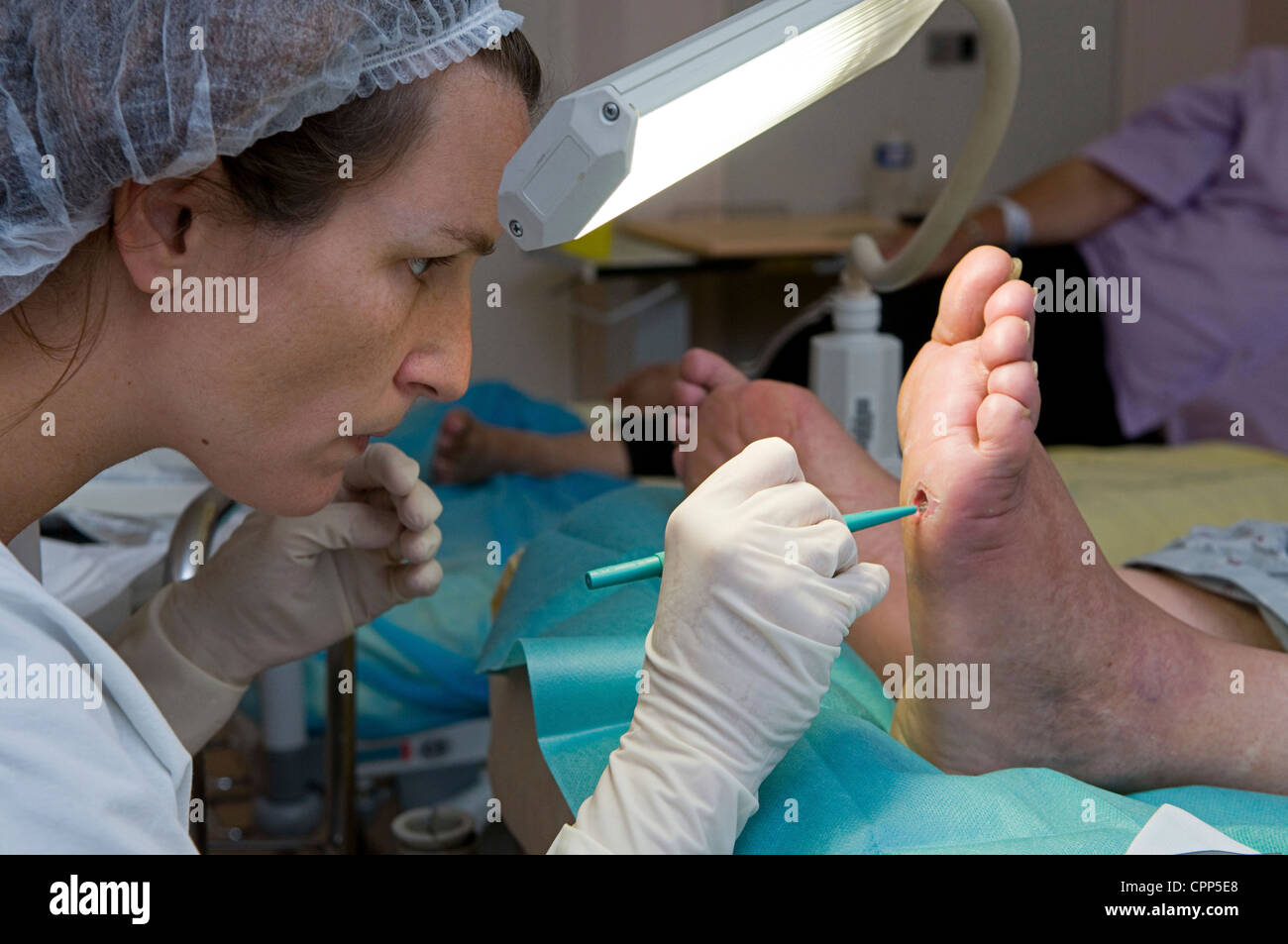 Diabetic foot ulcer hi-res stock photography and images - Alamy