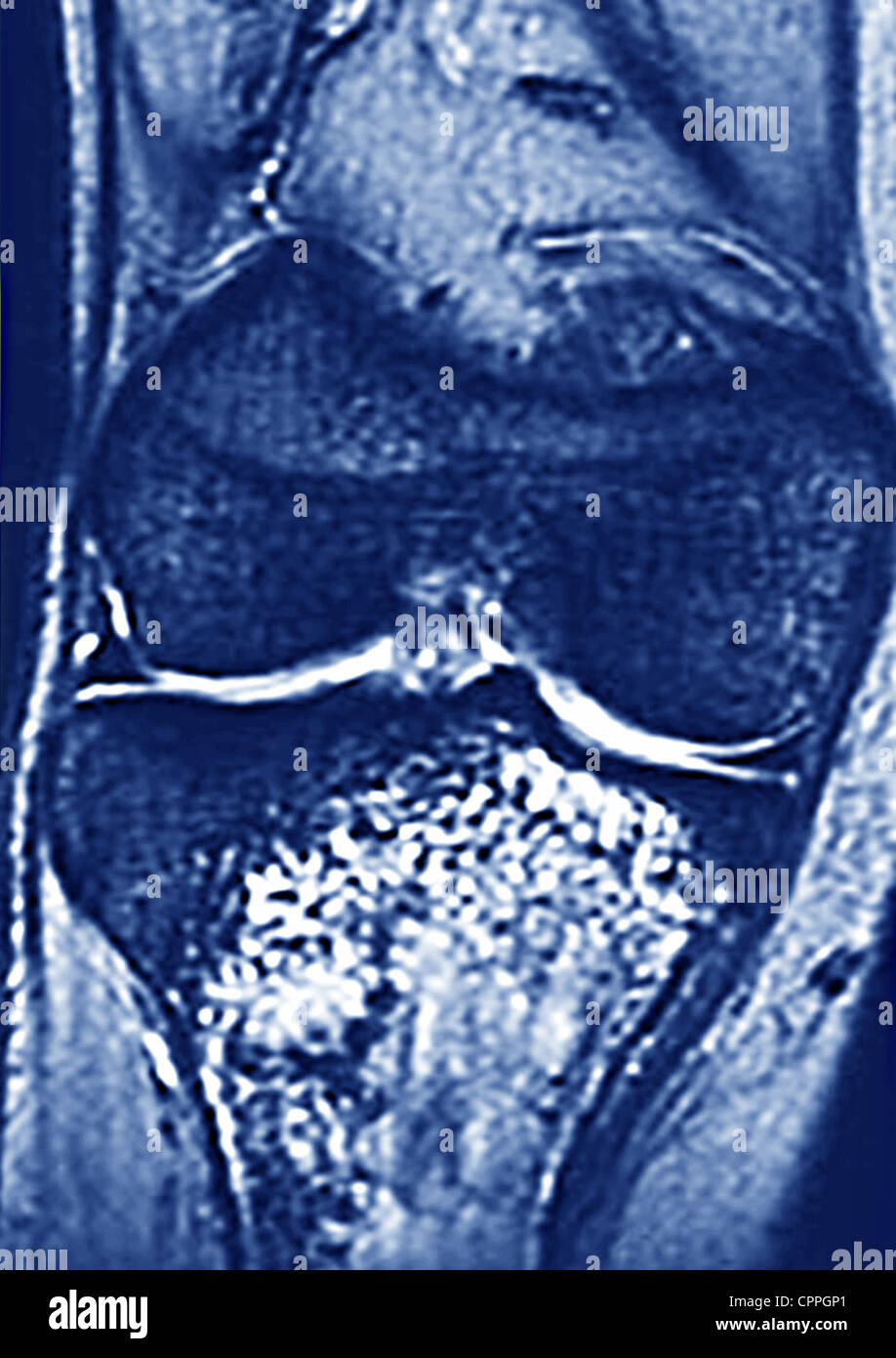 knee hires stock photography and images Alamy