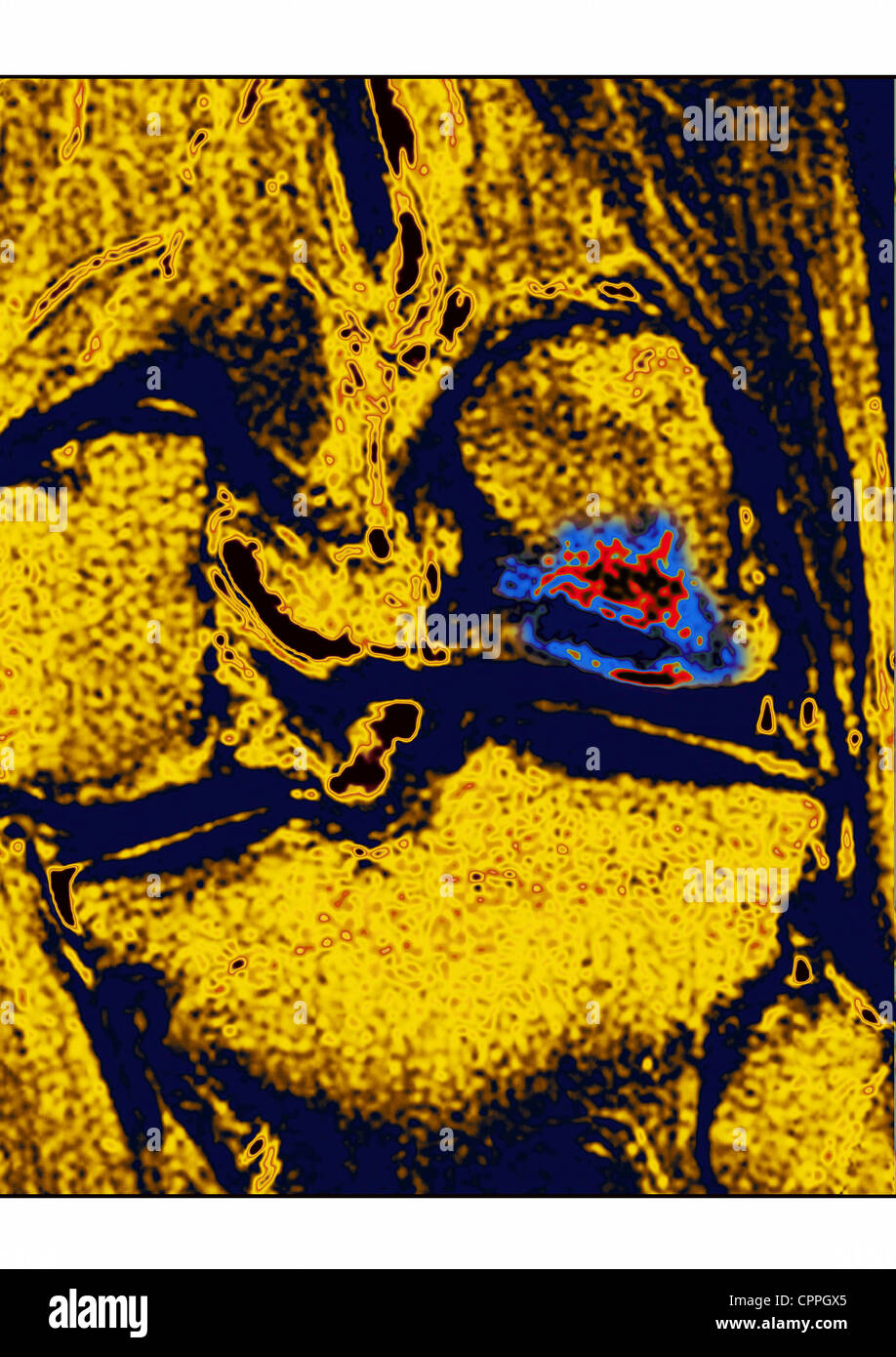 Mri of long bones hires stock photography and images Alamy