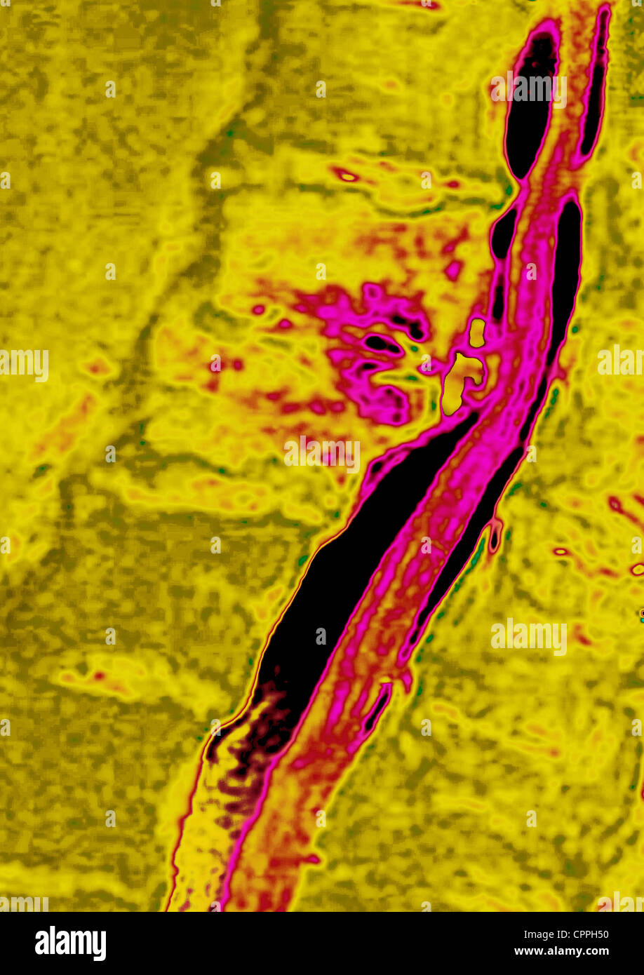 Mri of thoracic spine hi-res stock photography and images - Alamy