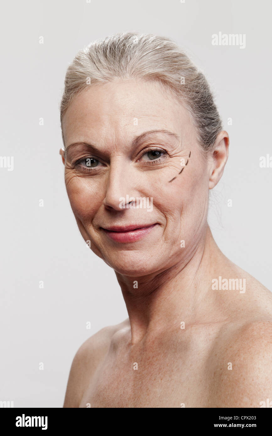 Mature woman with cosmetic surgery marking Stock Photo