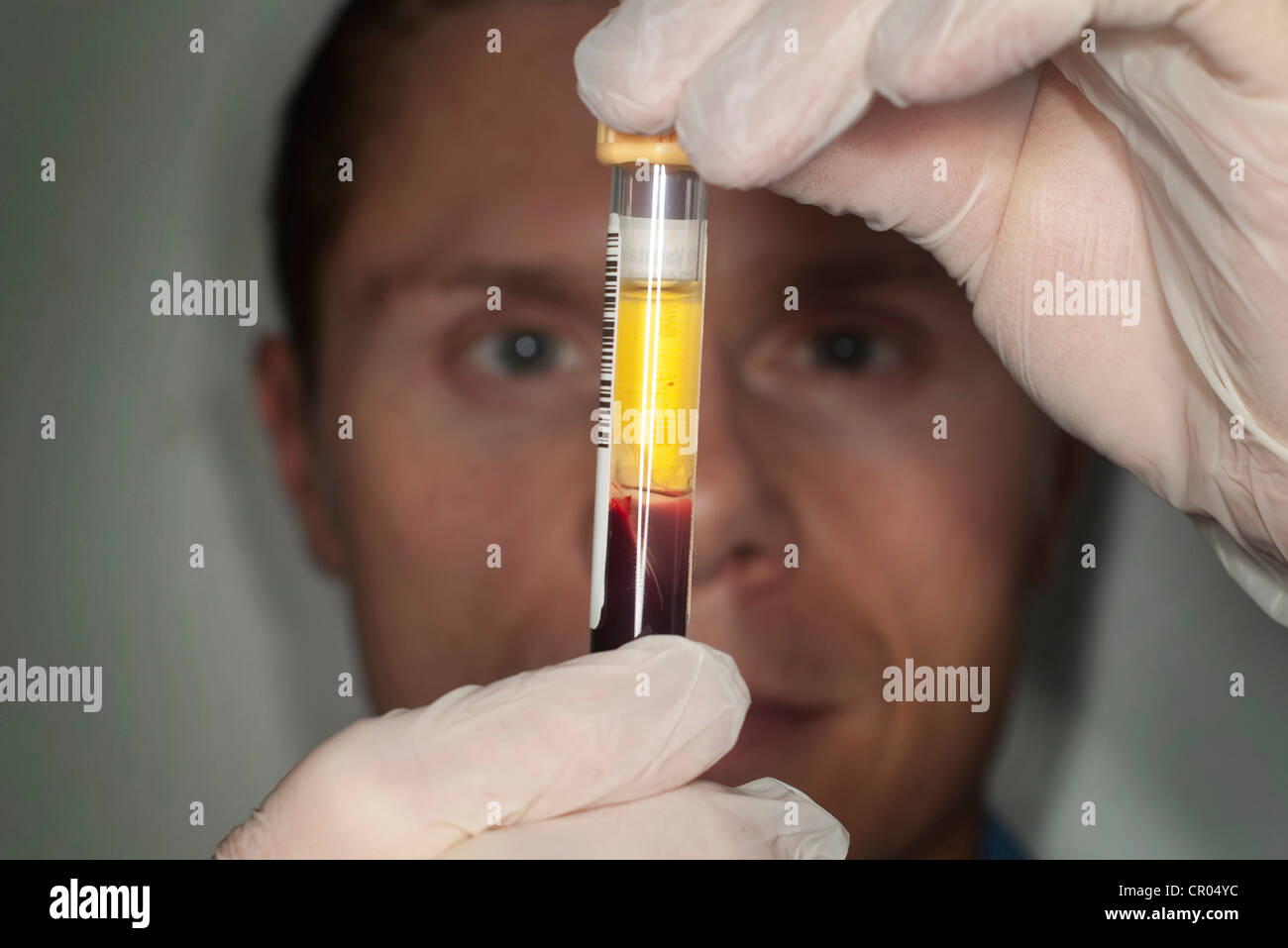 A doctor looks at a blood sample during a health check at a Nuffield