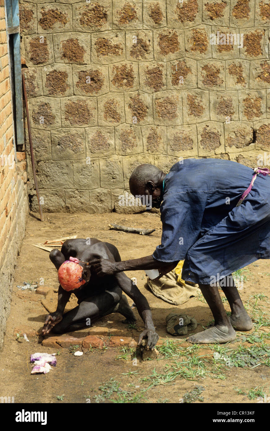 A Dinka man with a severe skin infection Stock Photo