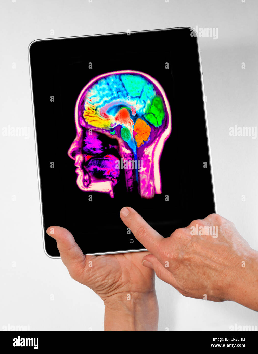 iPad showing an x-ray of an MRI scan of the brain Stock Photo