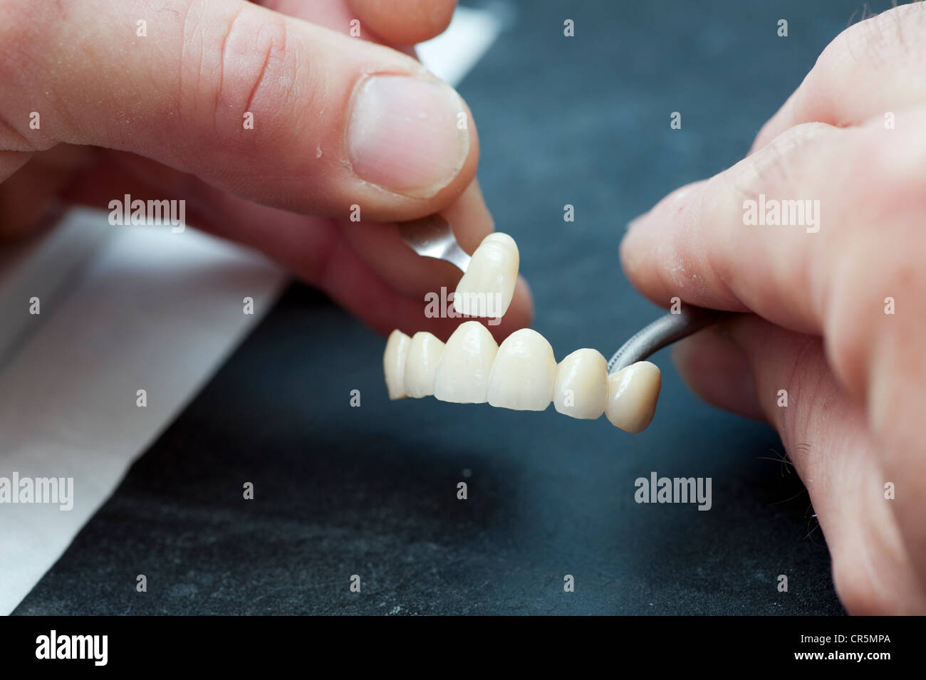 Color comparison of the dental crowns Stock Photo Alamy