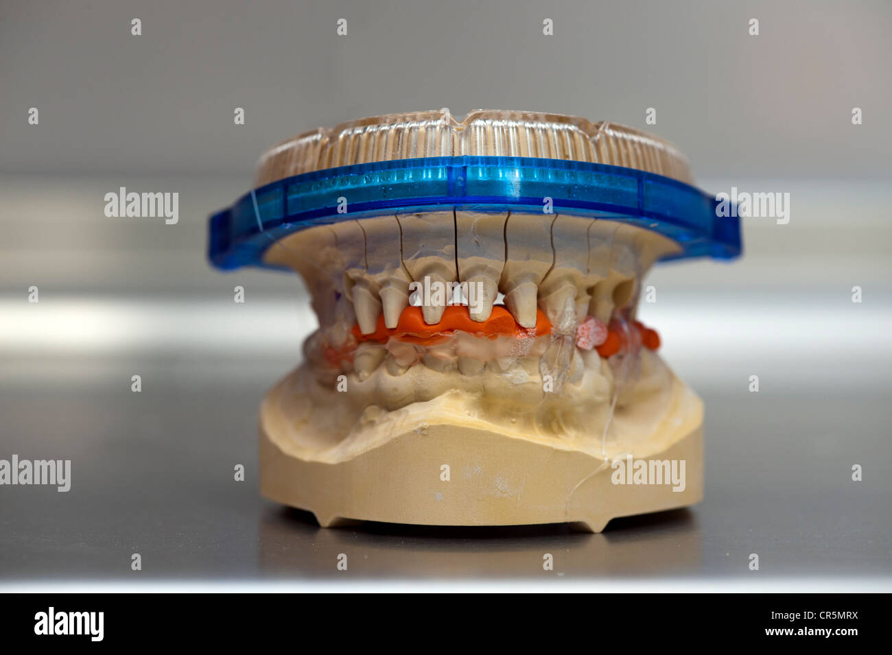 Dental model with upper and lower jaw Stock Photo