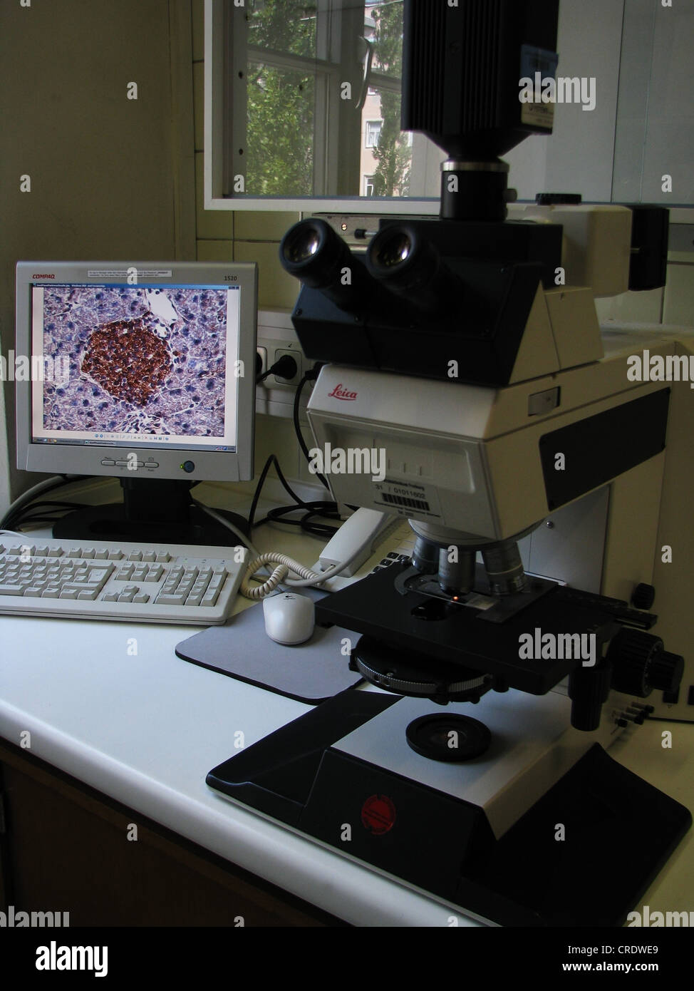 mikroscope is transmitting picture of a sample on a computers screen, Germany, Bavaria, Muenchen Stock Photo