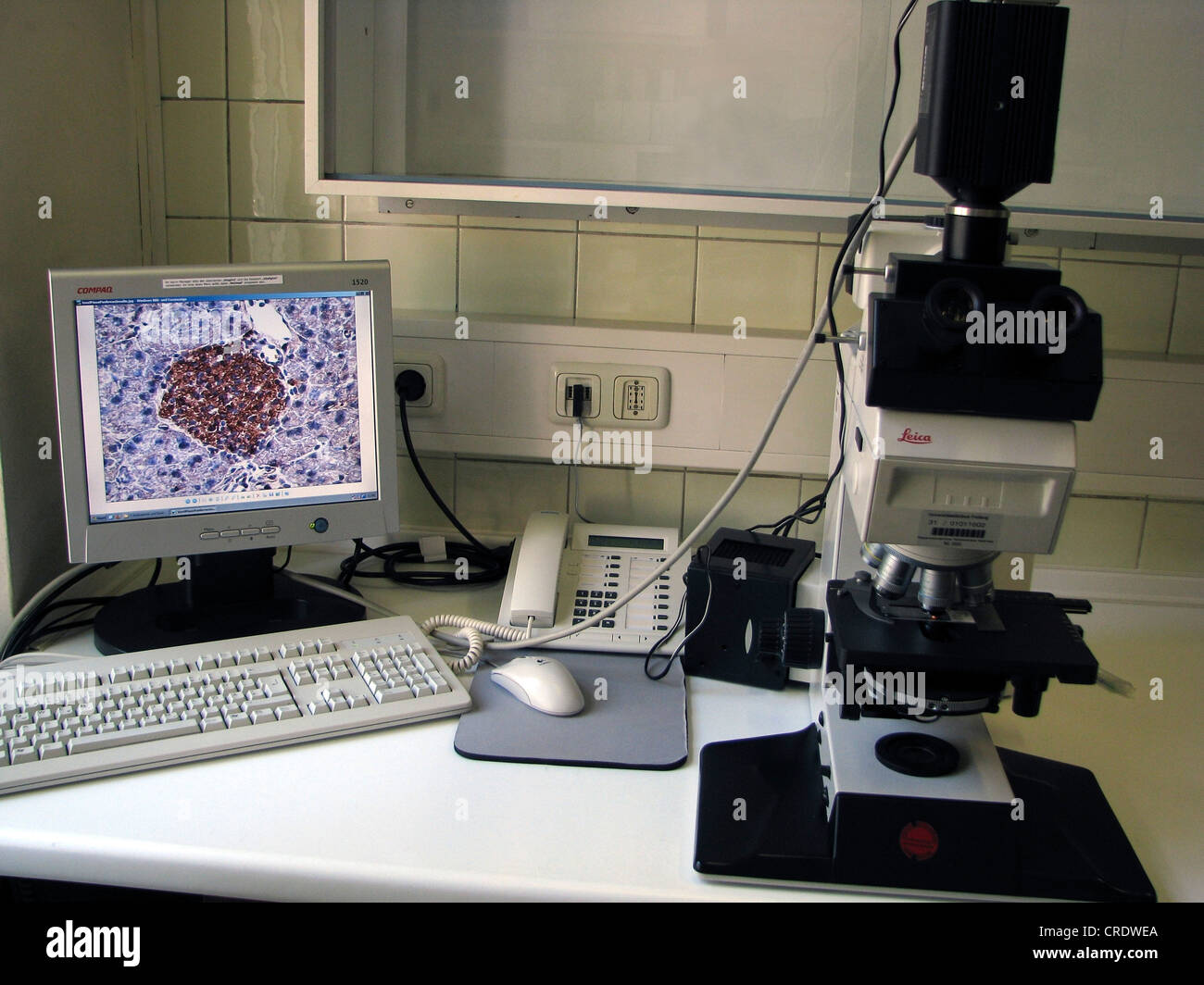 mikroscope is transmitting picture of a sample on a computers screen, Germany, Bavaria, Muenchen Stock Photo