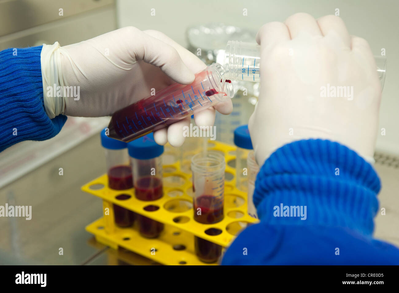 Treatment of a patient's blood in a sterile bench, Institute for Medical Microbiology, Immunology and Hygiene Stock Photo