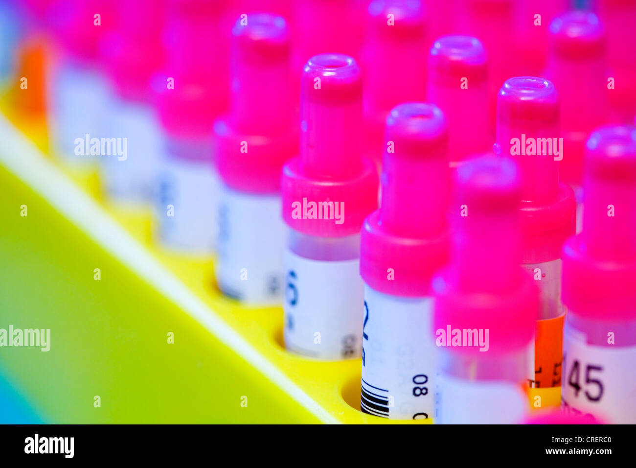 Many Blood Samples Number of samples hi-res stock photography and images - Alamy