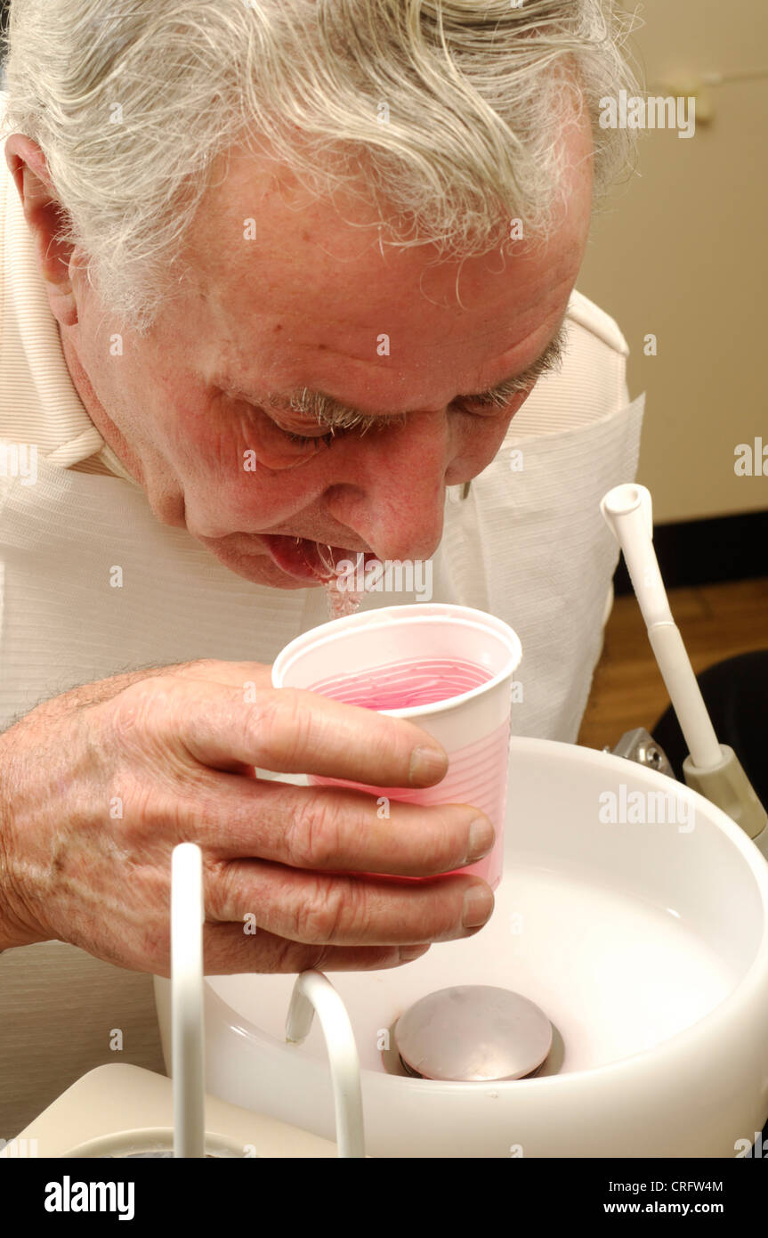An elderly man sits over a surgery basin to rinse with antimicrobial