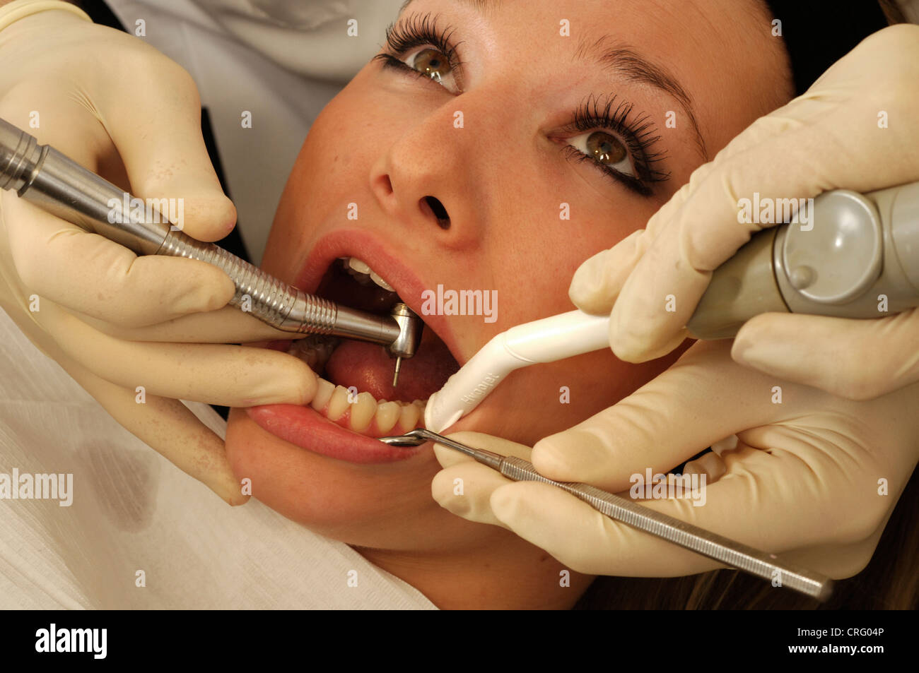 A dentist drills through the decaying teeth of a young female patient