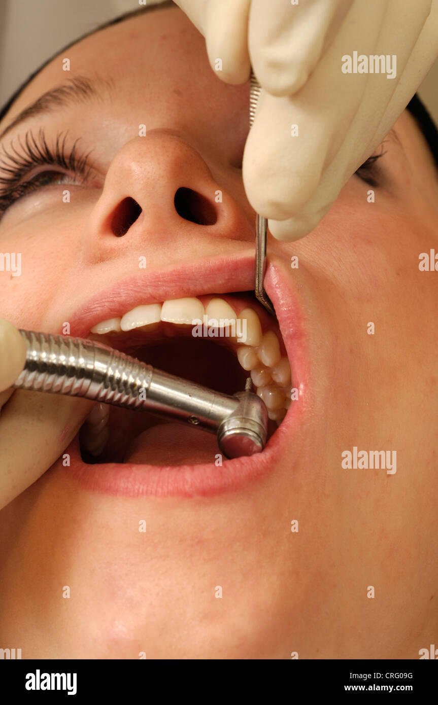 Close up of a dental drill being used to remove the decayed part of a young girl's tooth. Stock Photo