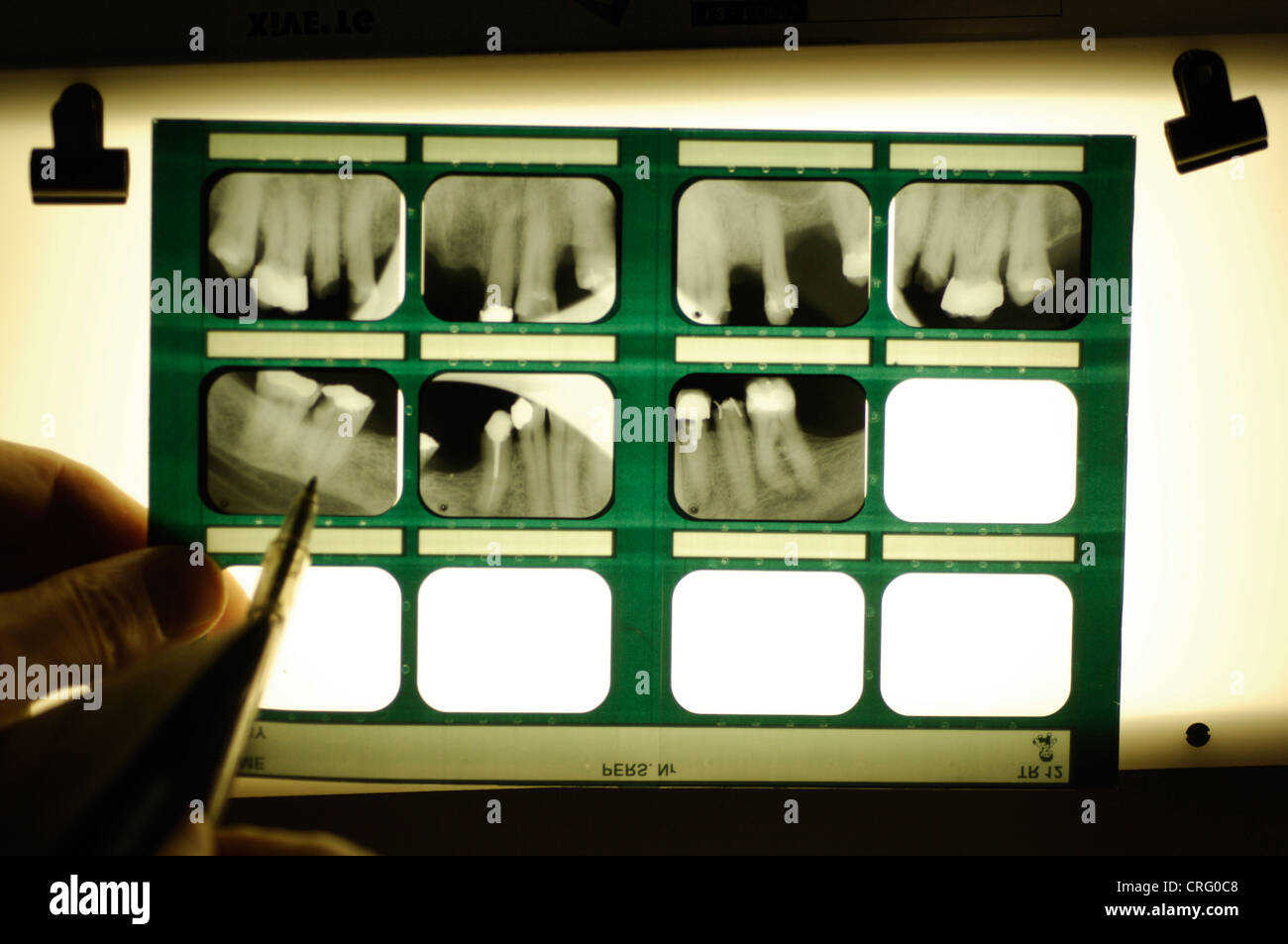 A dentist examines a set of dental x-rays. Stock Photo