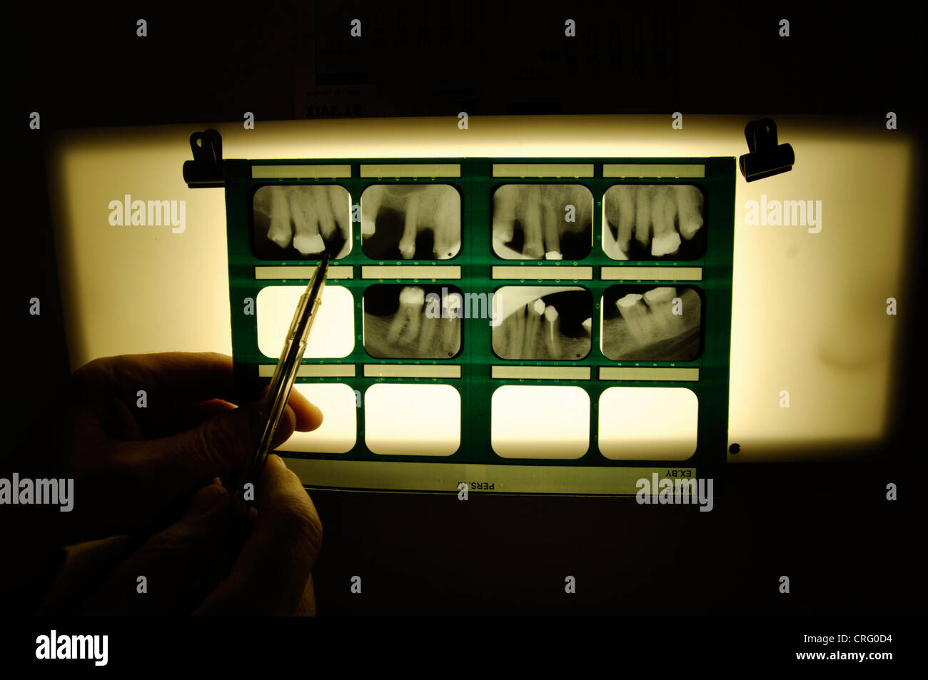 A dentist examining a set of patient x-rays. Stock Photo