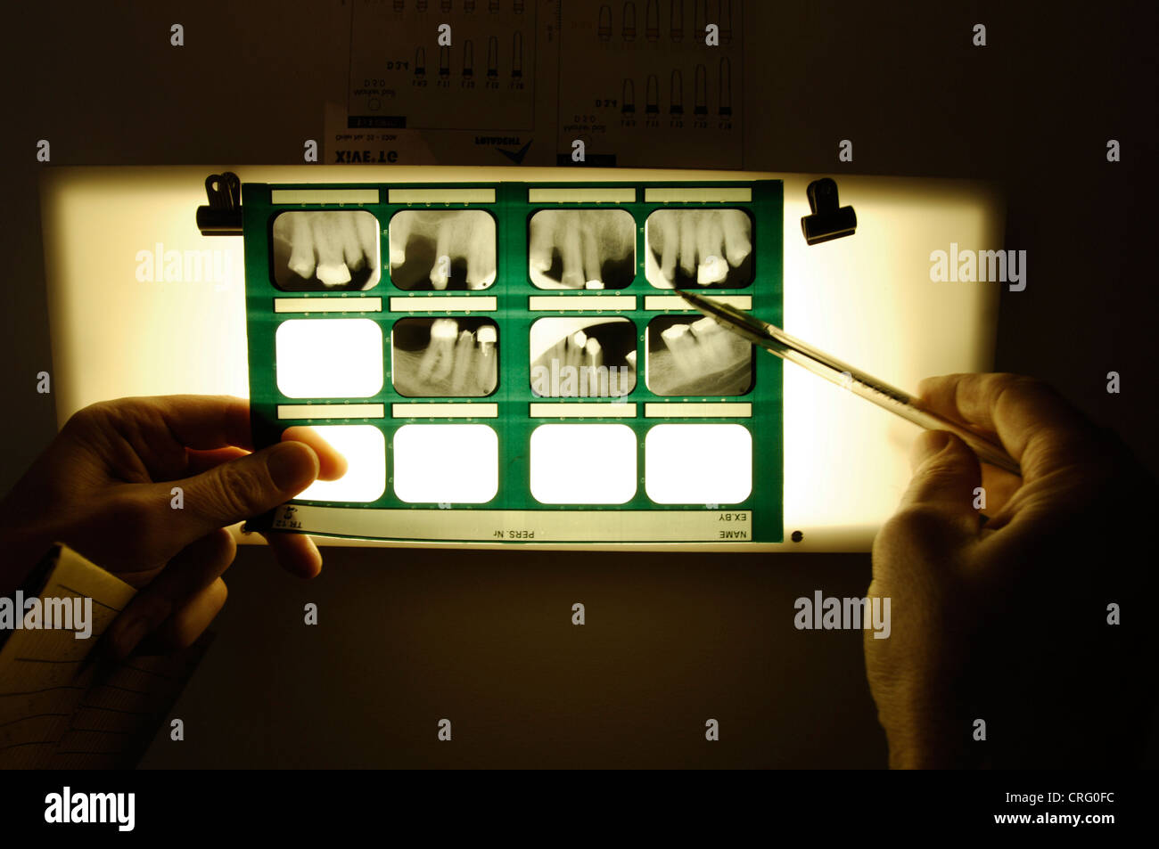 A dentist examines a patient's dental x-ray. Stock Photo