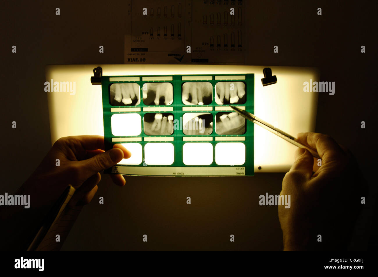 A dentist examining a set of patient x-rays. Stock Photo