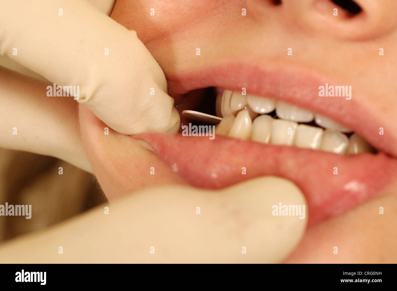 A young girl biting on the biting of a x-ray film before an image is taken of her teeth during a dental check-up. Stock Photo