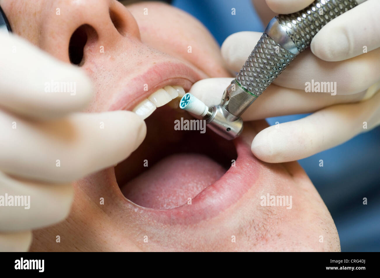 Dentist drill hires stock photography and images Alamy