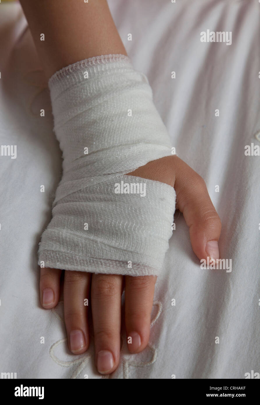 Young girl with bandaged hand Stock Photo